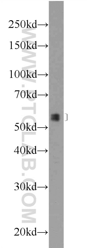 Western Blot (WB) analysis of mouse colon tissue using POLG2 Polyclonal antibody (10997-2-AP)
