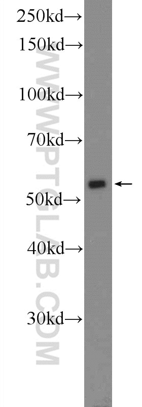 Western Blot (WB) analysis of COLO 320 cells using POLG2 Polyclonal antibody (10997-2-AP)