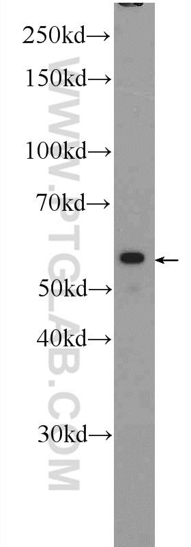 Western Blot (WB) analysis of HeLa cells using POLG2 Polyclonal antibody (10997-2-AP)