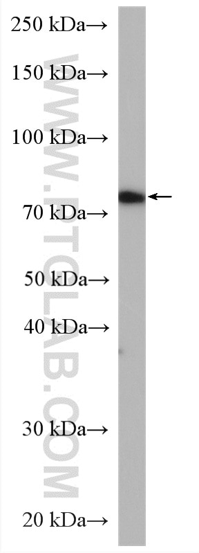 Western Blot (WB) analysis of HeLa cells using POLH Polyclonal antibody (28133-1-AP)