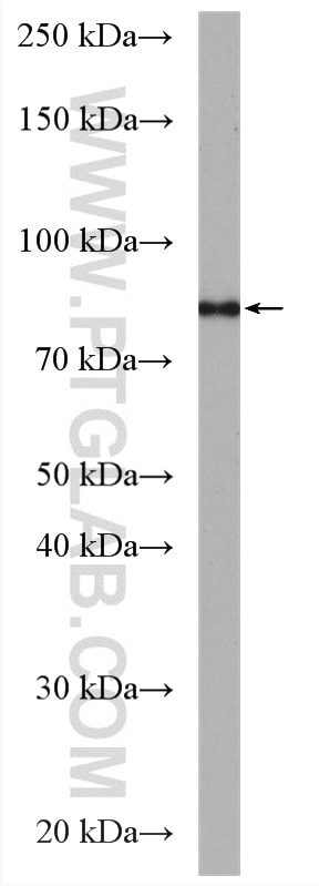 Western Blot (WB) analysis of COLO 320 cells using POLH Polyclonal antibody (28133-1-AP)