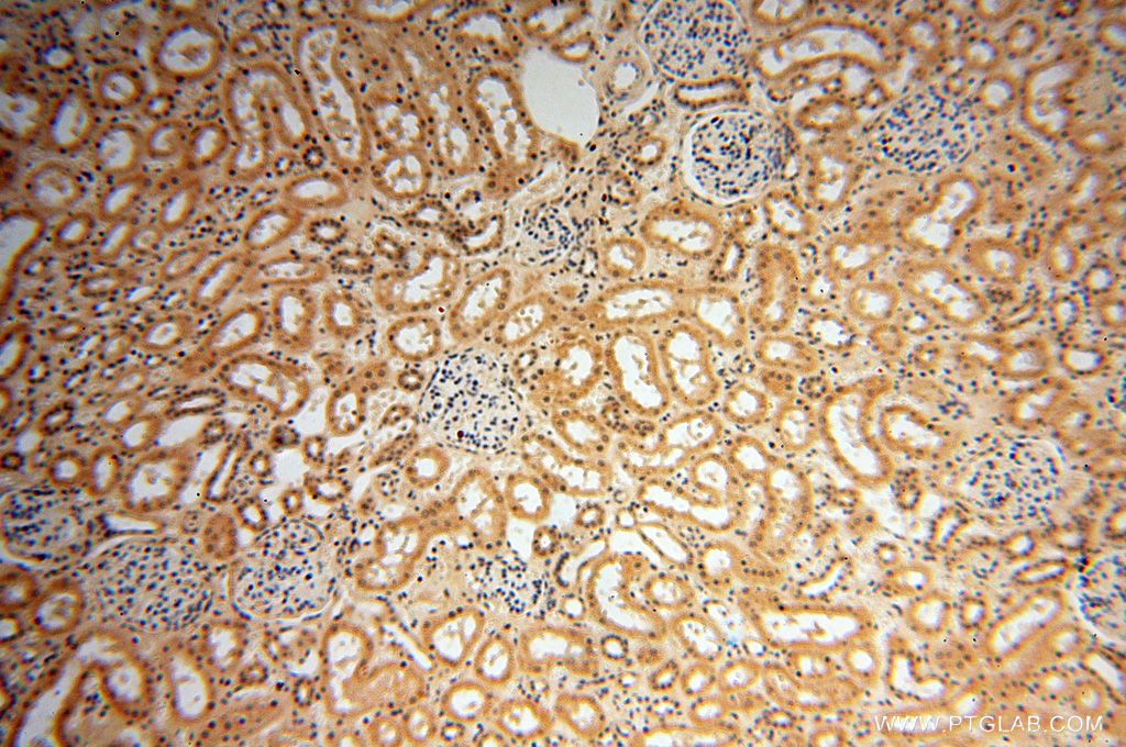 Immunohistochemistry (IHC) staining of human kidney tissue using POLM Polyclonal antibody (14873-1-AP)