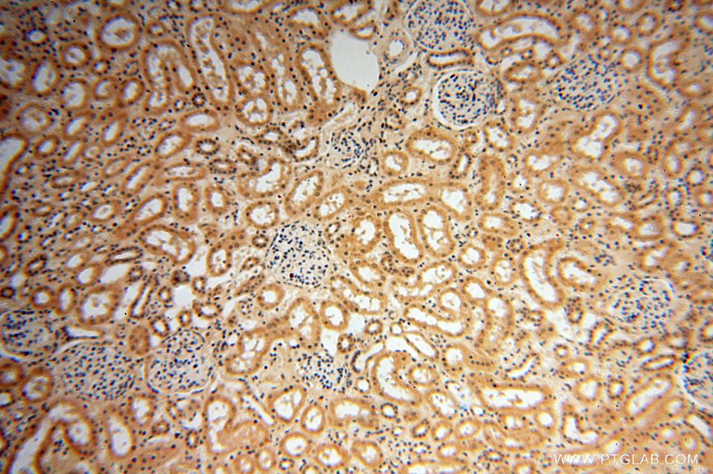 Immunohistochemistry (IHC) staining of human kidney tissue using POLM Polyclonal antibody (14873-1-AP)
