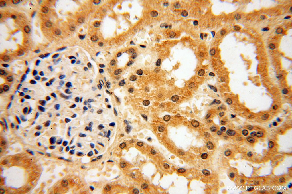Immunohistochemistry (IHC) staining of human kidney tissue using POLM Polyclonal antibody (14873-1-AP)