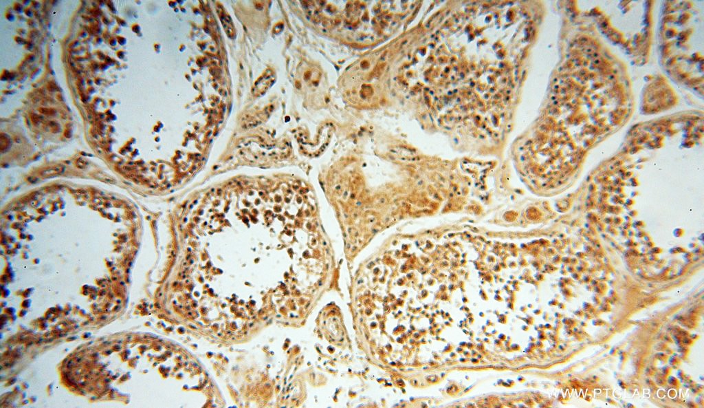 Immunohistochemistry (IHC) staining of human testis tissue using POLM Polyclonal antibody (14873-1-AP)