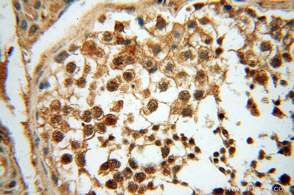 Immunohistochemistry (IHC) staining of human testis tissue using POLM Polyclonal antibody (14873-1-AP)
