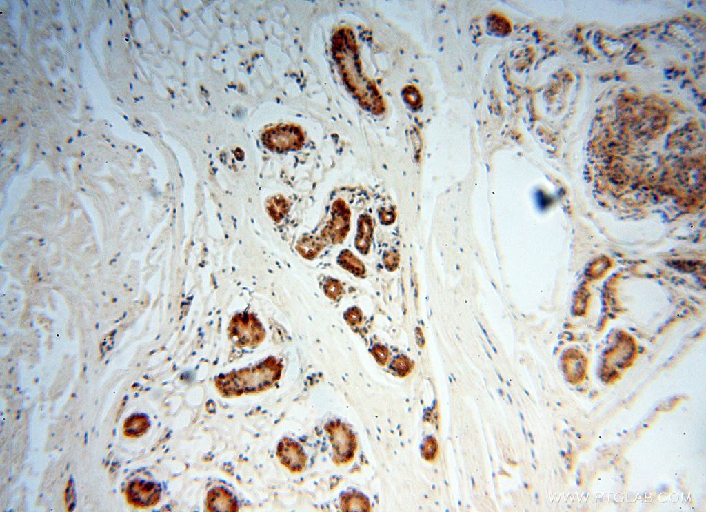 Immunohistochemistry (IHC) staining of human skin tissue using POLM Polyclonal antibody (14873-1-AP)