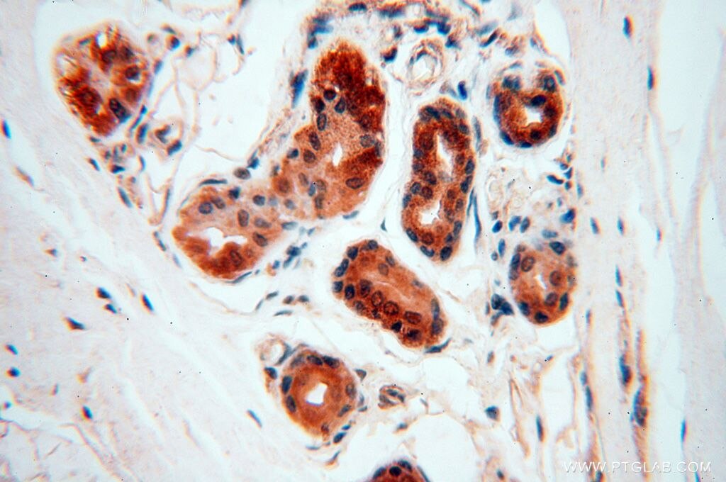 Immunohistochemistry (IHC) staining of human skin tissue using POLM Polyclonal antibody (14873-1-AP)