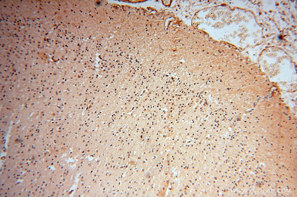 Immunohistochemistry (IHC) staining of human brain tissue using POLM Polyclonal antibody (14873-1-AP)