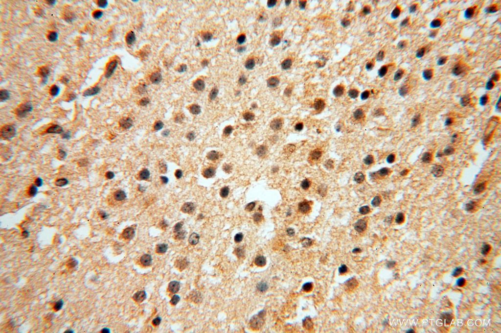 Immunohistochemistry (IHC) staining of human brain tissue using POLM Polyclonal antibody (14873-1-AP)