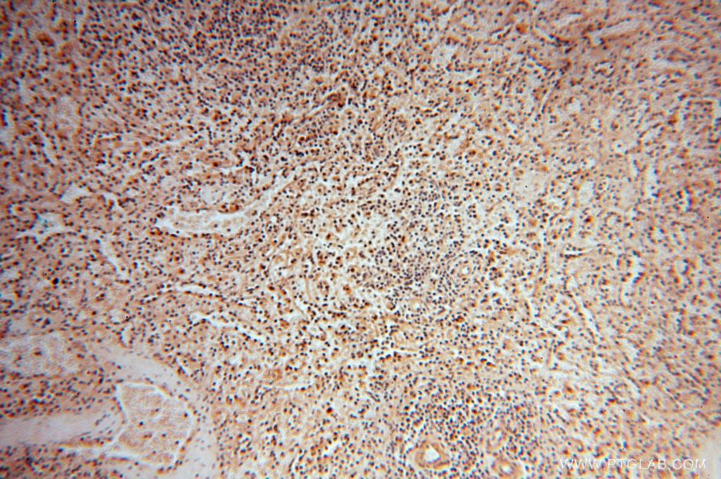 Immunohistochemistry (IHC) staining of human spleen tissue using POLM Polyclonal antibody (14873-1-AP)