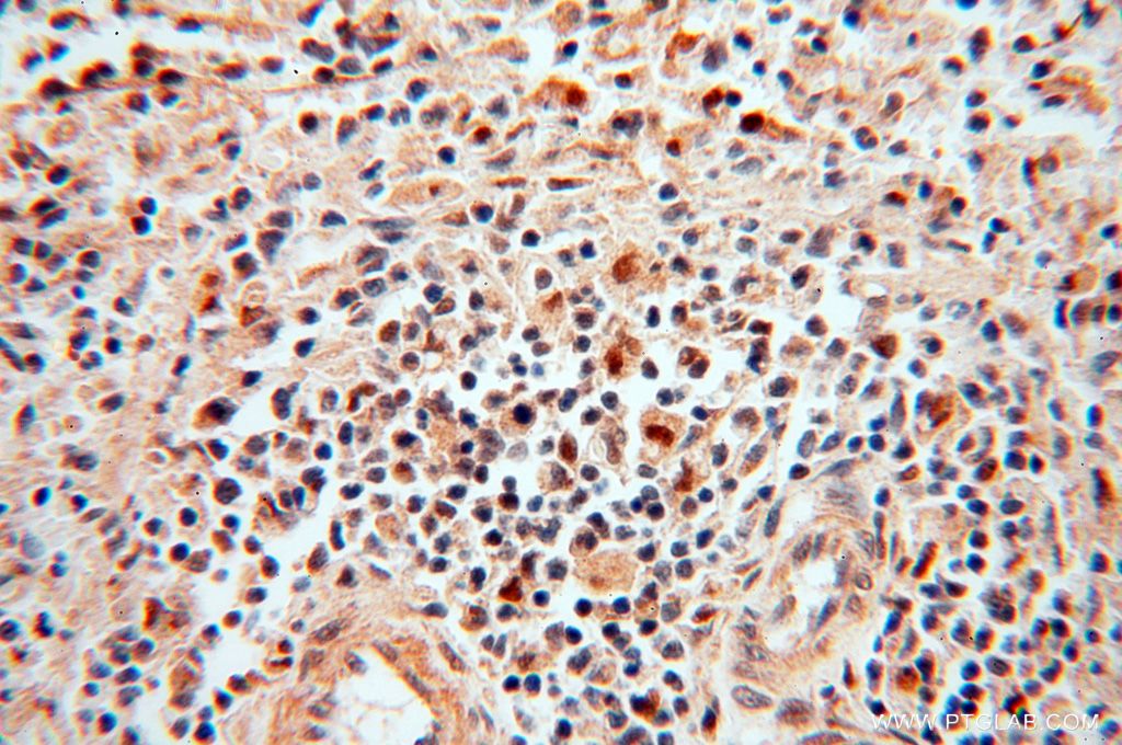 Immunohistochemistry (IHC) staining of human spleen tissue using POLM Polyclonal antibody (14873-1-AP)