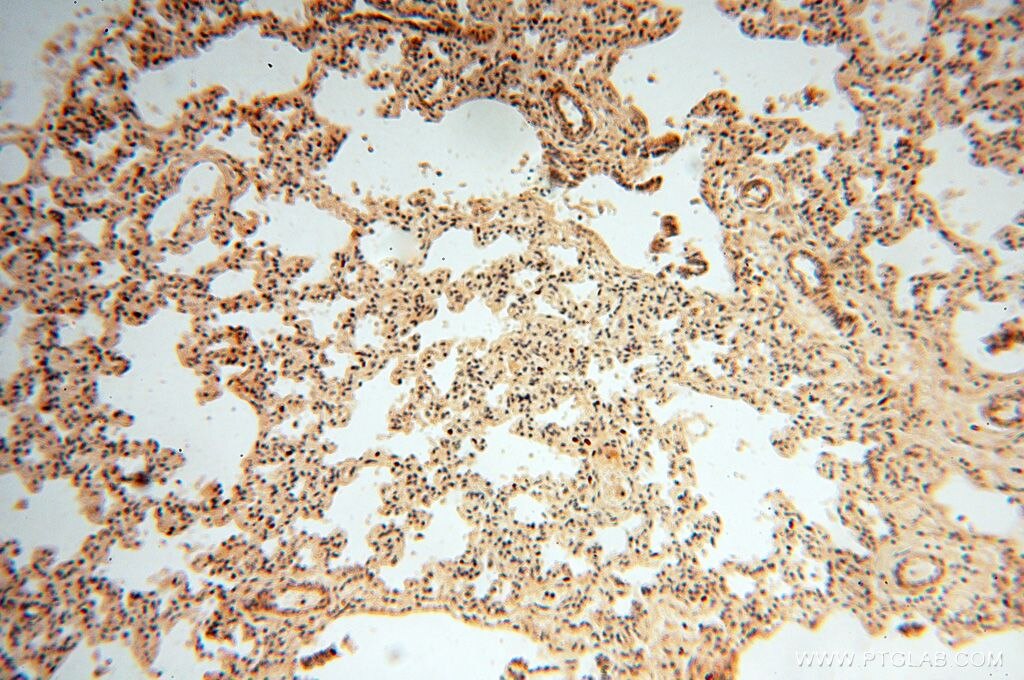 Immunohistochemistry (IHC) staining of human lung tissue using POLM Polyclonal antibody (14873-1-AP)