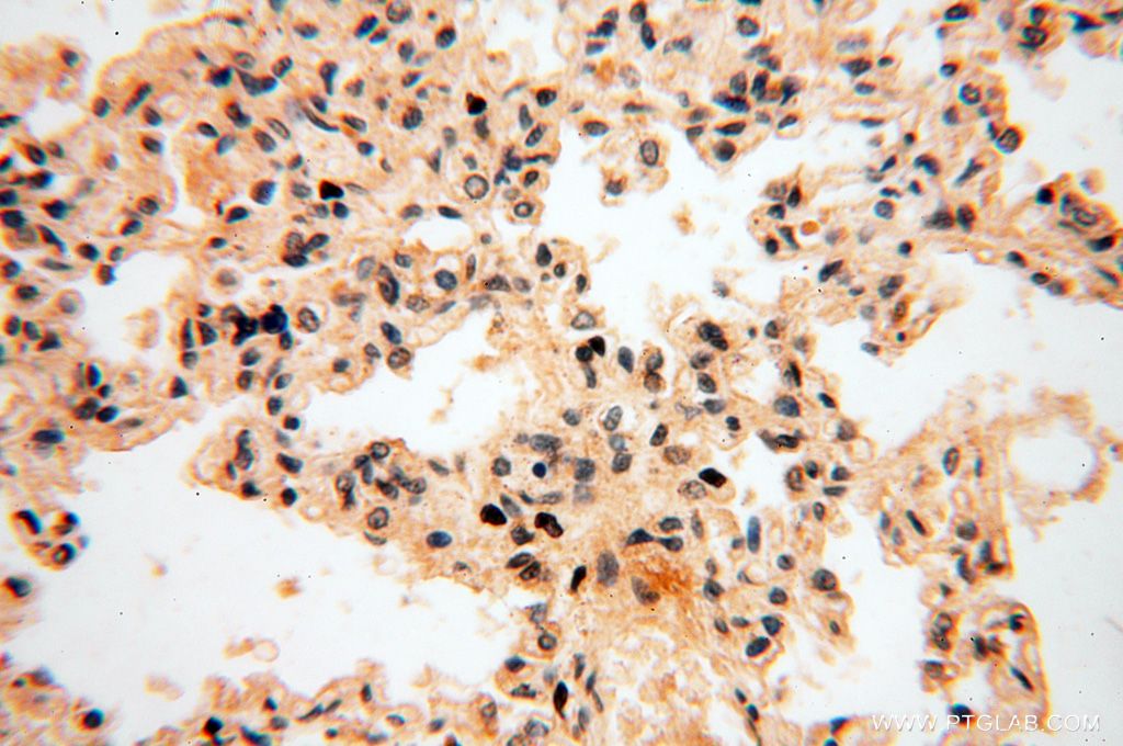 Immunohistochemistry (IHC) staining of human lung tissue using POLM Polyclonal antibody (14873-1-AP)