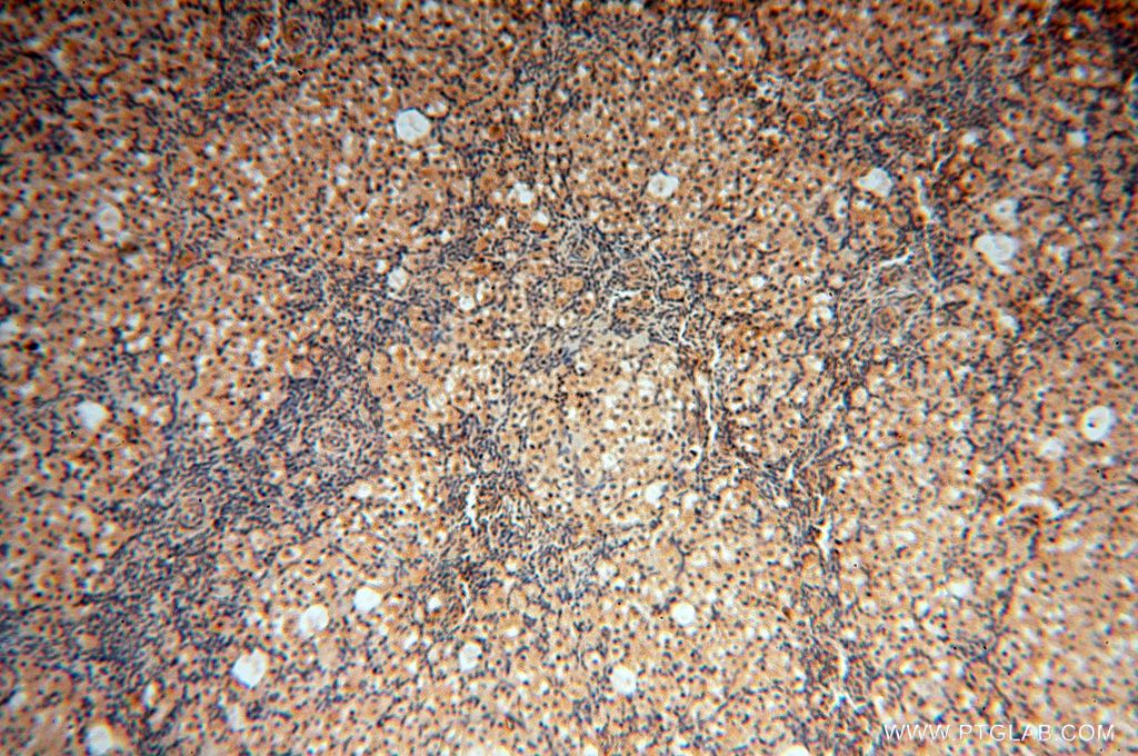 Immunohistochemistry (IHC) staining of human ovary tissue using POLM Polyclonal antibody (14873-1-AP)