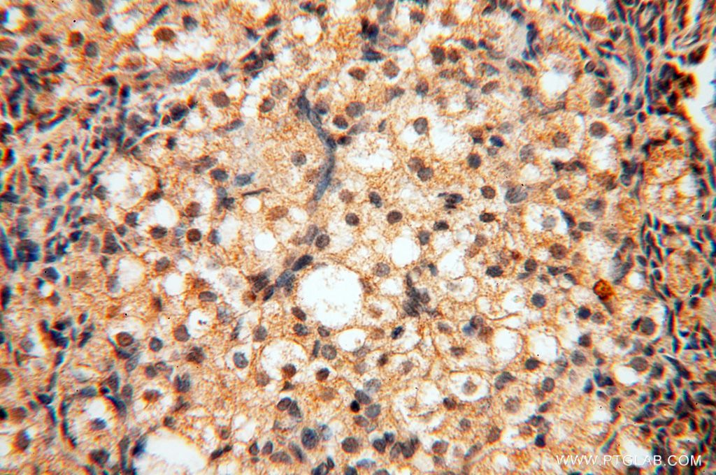 Immunohistochemistry (IHC) staining of human ovary tissue using POLM Polyclonal antibody (14873-1-AP)