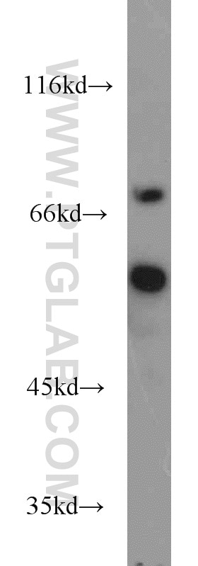 Western Blot (WB) analysis of Jurkat cells using POLM Polyclonal antibody (14873-1-AP)