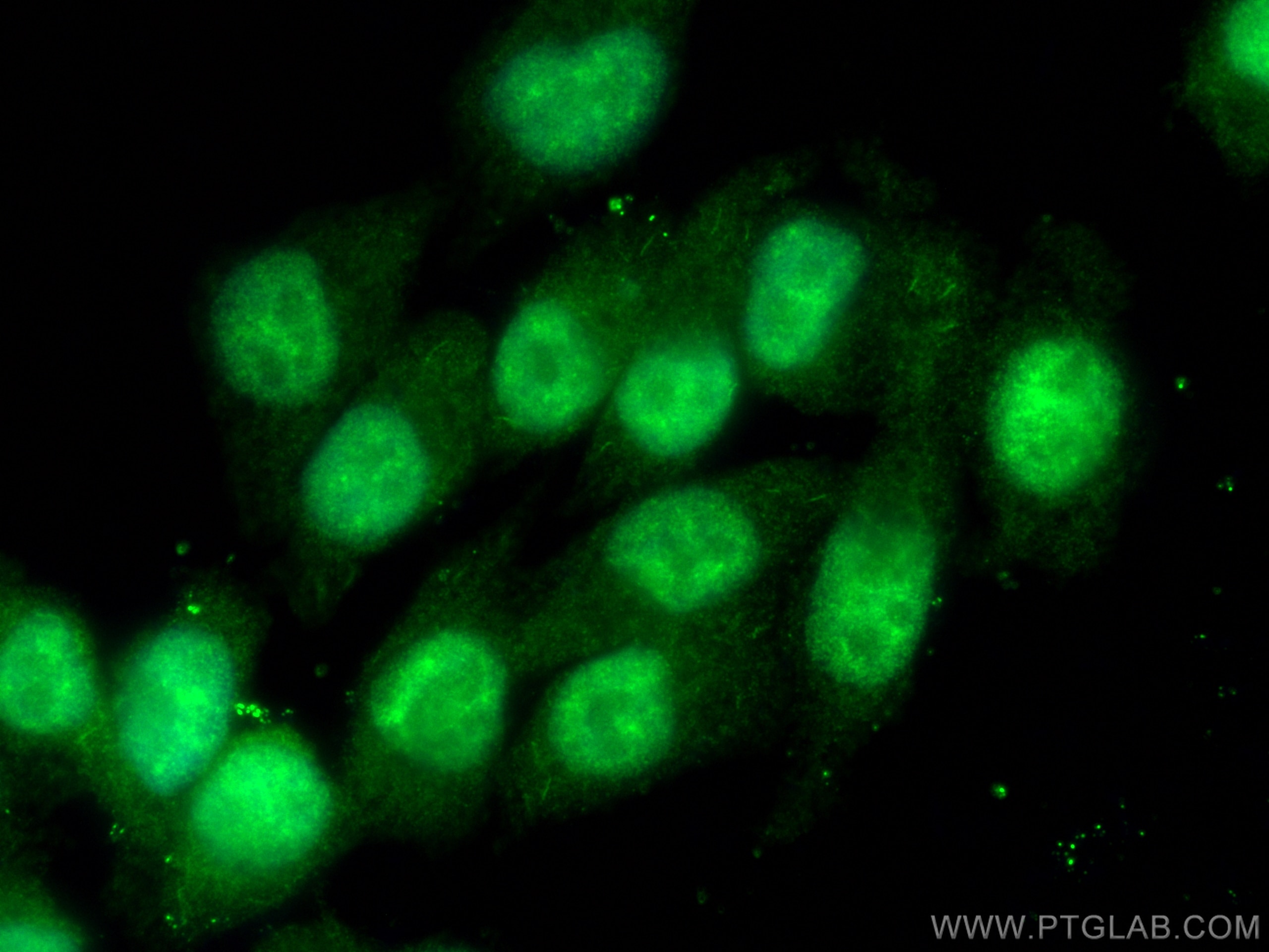 Immunofluorescence (IF) / fluorescent staining of A375 cells using POLQ Polyclonal antibody (28590-1-AP)