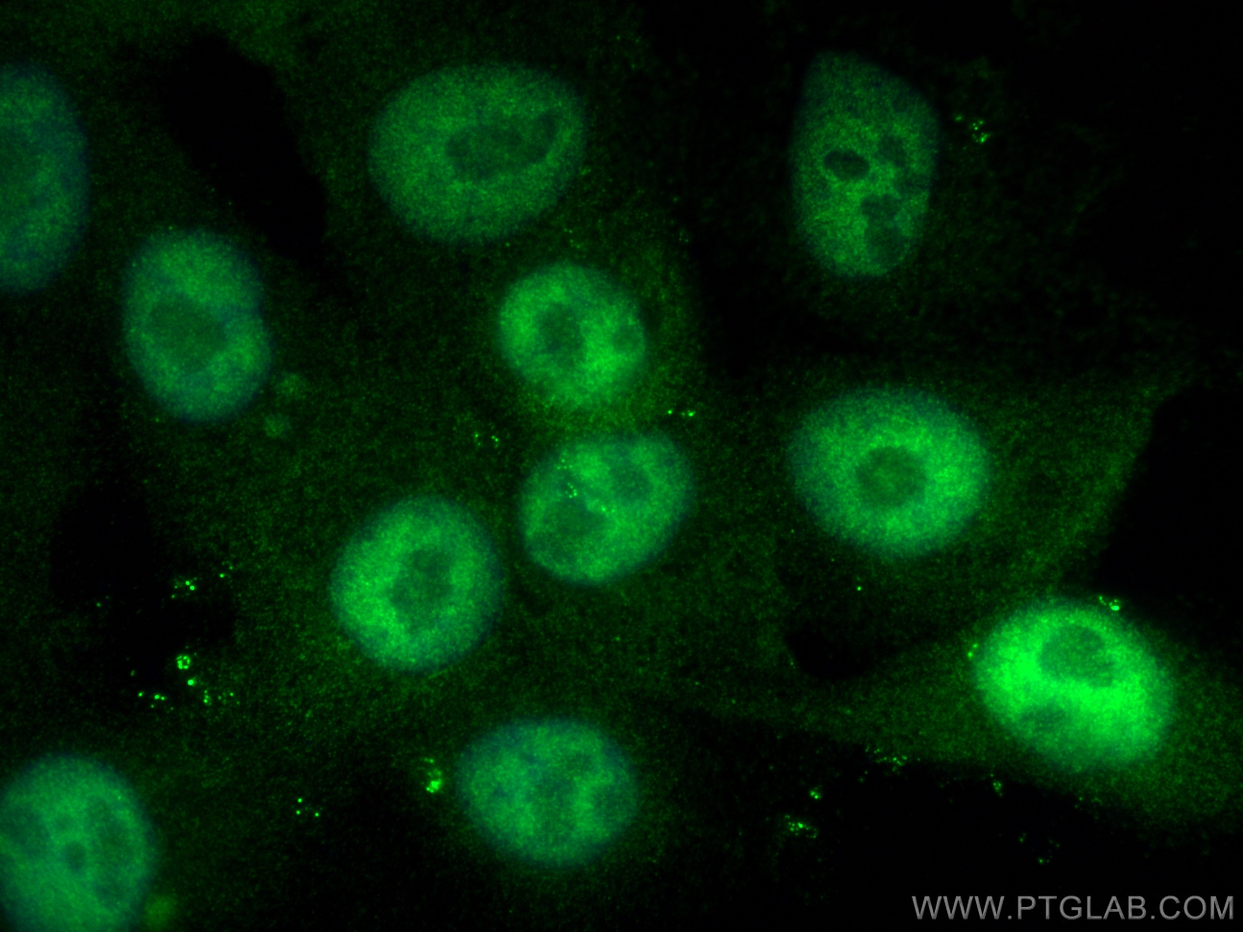 Immunofluorescence (IF) / fluorescent staining of A431 cells using POLQ Polyclonal antibody (28590-1-AP)