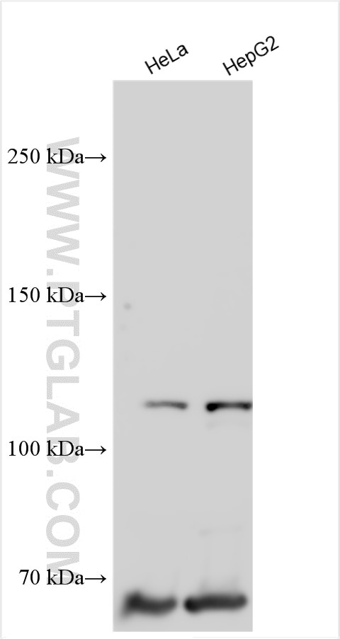 Western Blot (WB) analysis of various lysates using POLQ Polyclonal antibody (28590-1-AP)