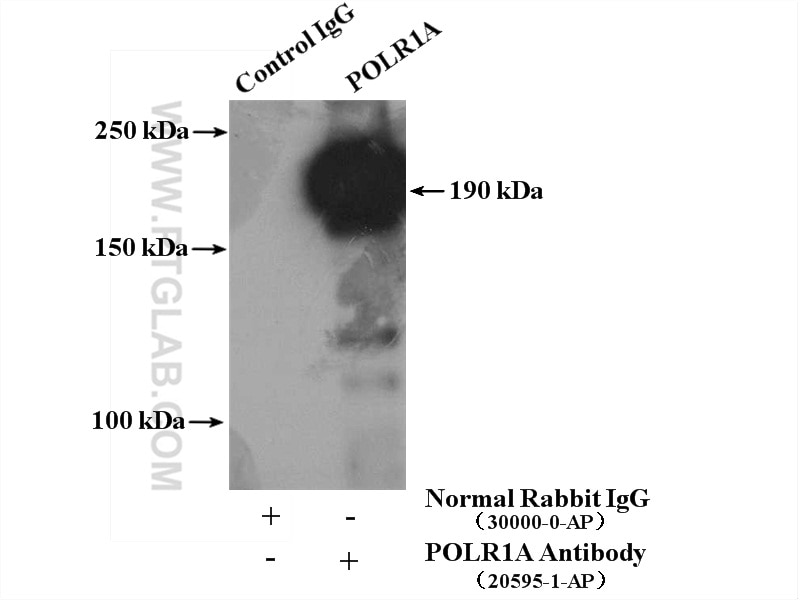 Immunoprecipitation (IP) experiment of HeLa cells using POLR1A Polyclonal antibody (20595-1-AP)