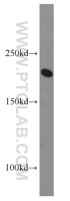 Western Blot (WB) analysis of HeLa cells using POLR1A Polyclonal antibody (20595-1-AP)