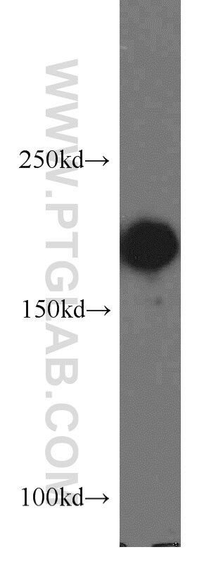 Western Blot (WB) analysis of HepG2 cells using POLR1A Polyclonal antibody (20595-1-AP)