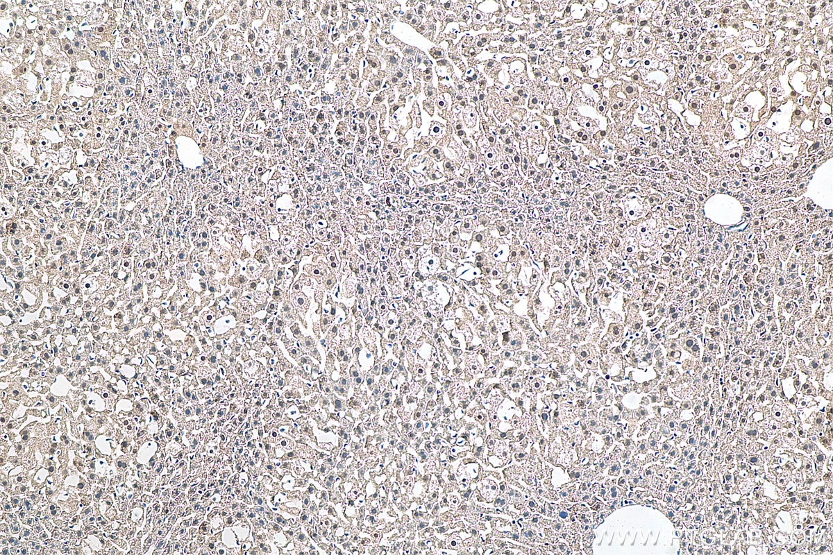 Immunohistochemistry (IHC) staining of mouse liver tissue using POLR1C Polyclonal antibody (15923-1-AP)