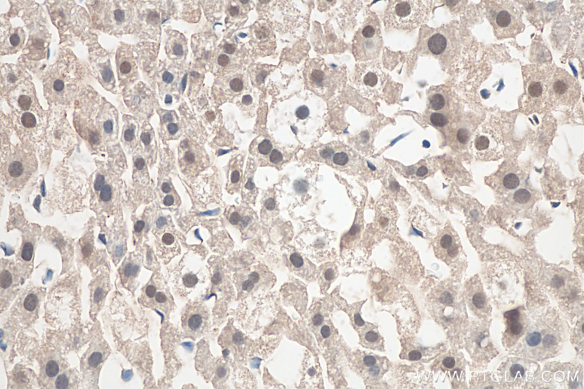 Immunohistochemistry (IHC) staining of mouse liver tissue using POLR1C Polyclonal antibody (15923-1-AP)