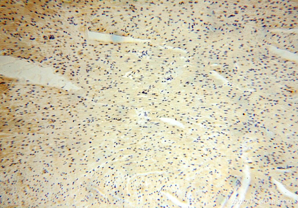 IHC staining of human heart using 15923-1-AP