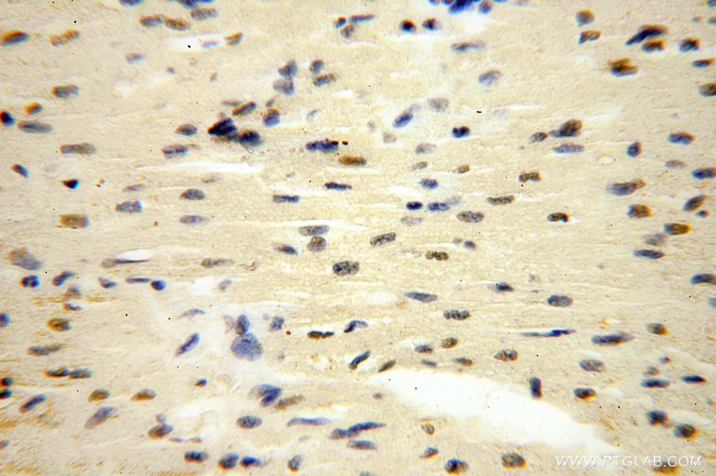 Immunohistochemistry (IHC) staining of human heart tissue using POLR1C Polyclonal antibody (15923-1-AP)