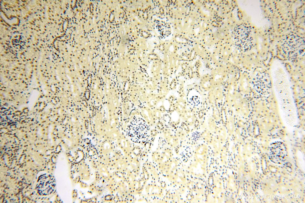 IHC staining of human kidney using 15923-1-AP