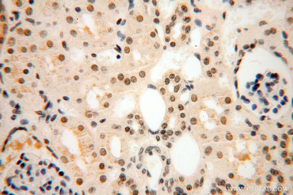Immunohistochemistry (IHC) staining of human kidney tissue using POLR1C Polyclonal antibody (15923-1-AP)