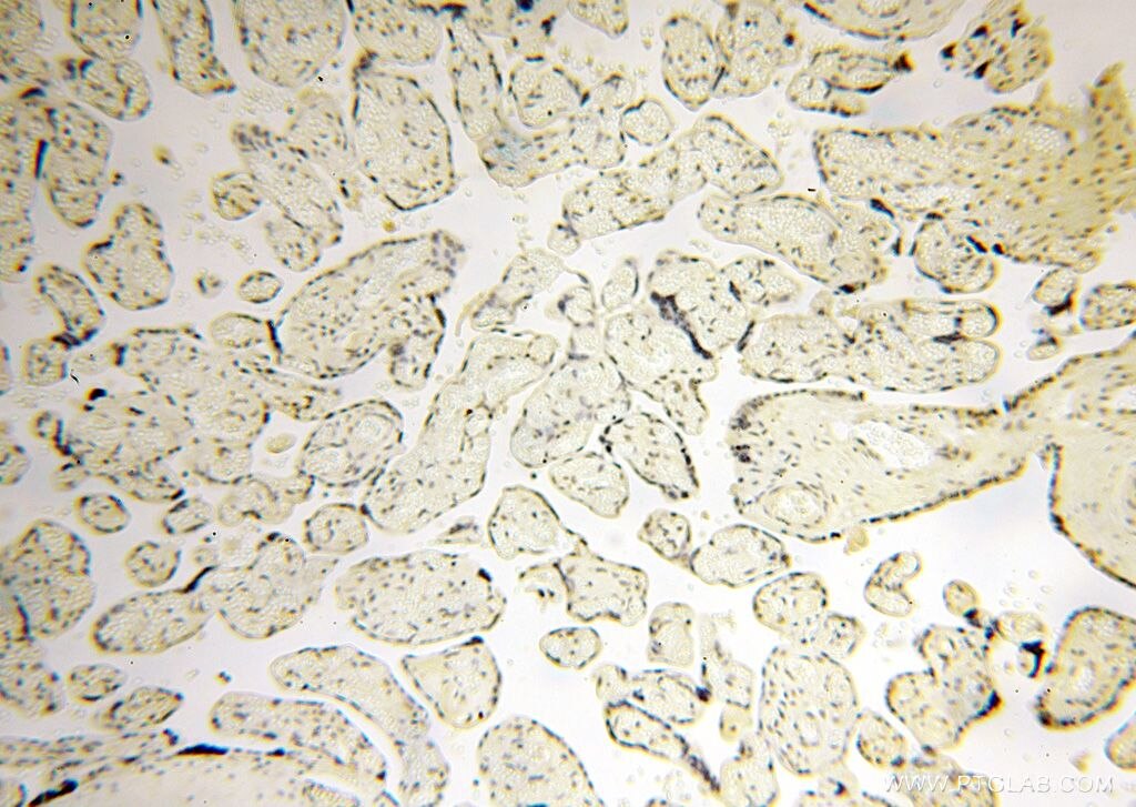 IHC staining of human placenta using 15923-1-AP