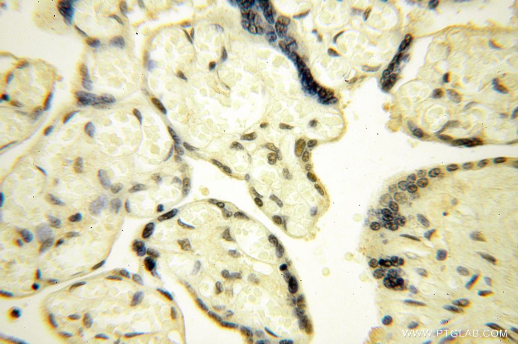 Immunohistochemistry (IHC) staining of human placenta tissue using POLR1C Polyclonal antibody (15923-1-AP)