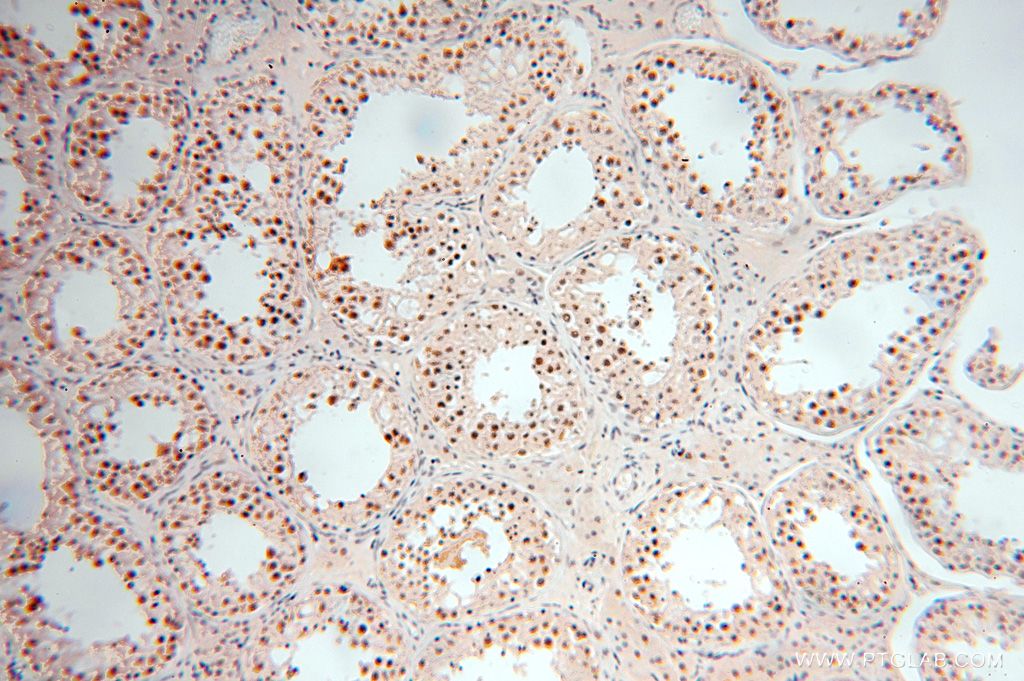 Immunohistochemistry (IHC) staining of human testis tissue using POLR1C Polyclonal antibody (15923-1-AP)