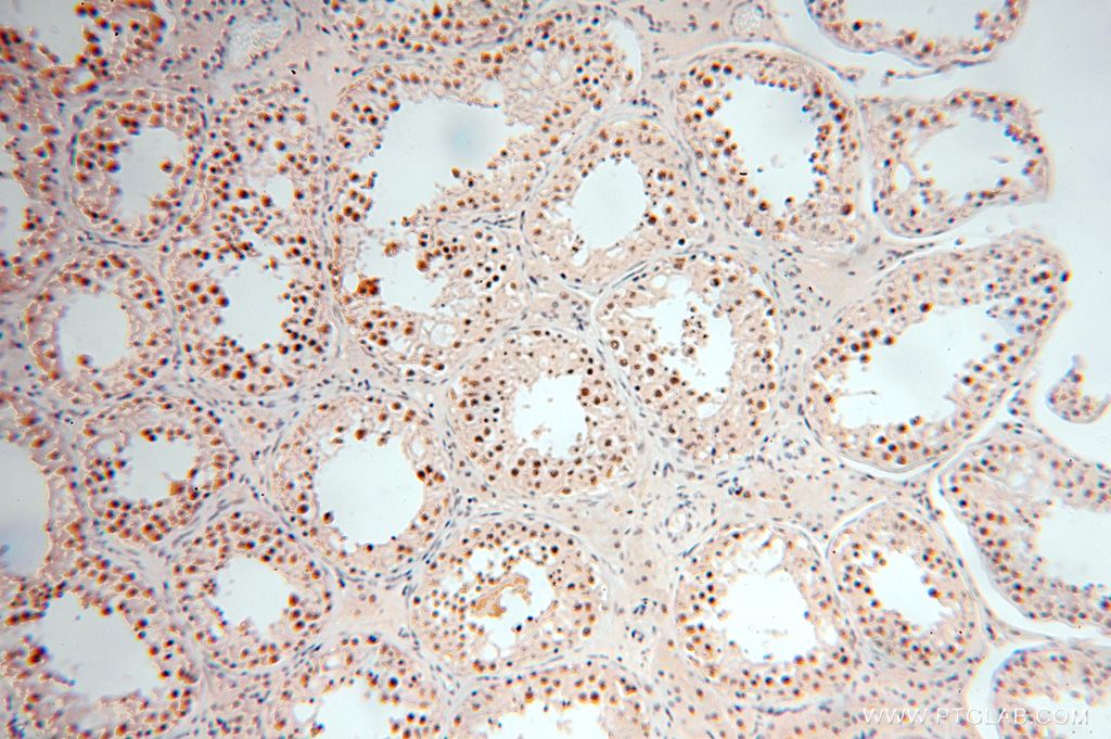 IHC staining of human testis using 15923-1-AP