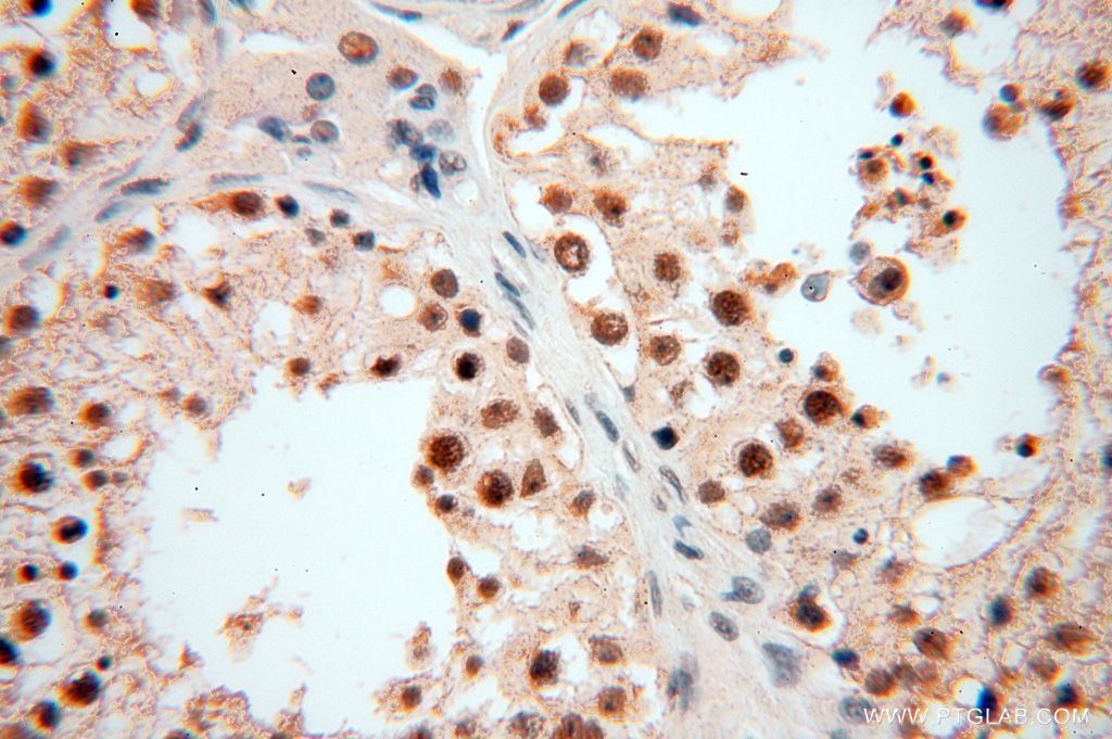 Immunohistochemistry (IHC) staining of human testis tissue using POLR1C Polyclonal antibody (15923-1-AP)