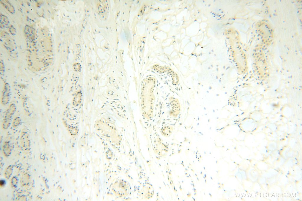Immunohistochemistry (IHC) staining of human skin tissue using POLR1C Polyclonal antibody (15923-1-AP)