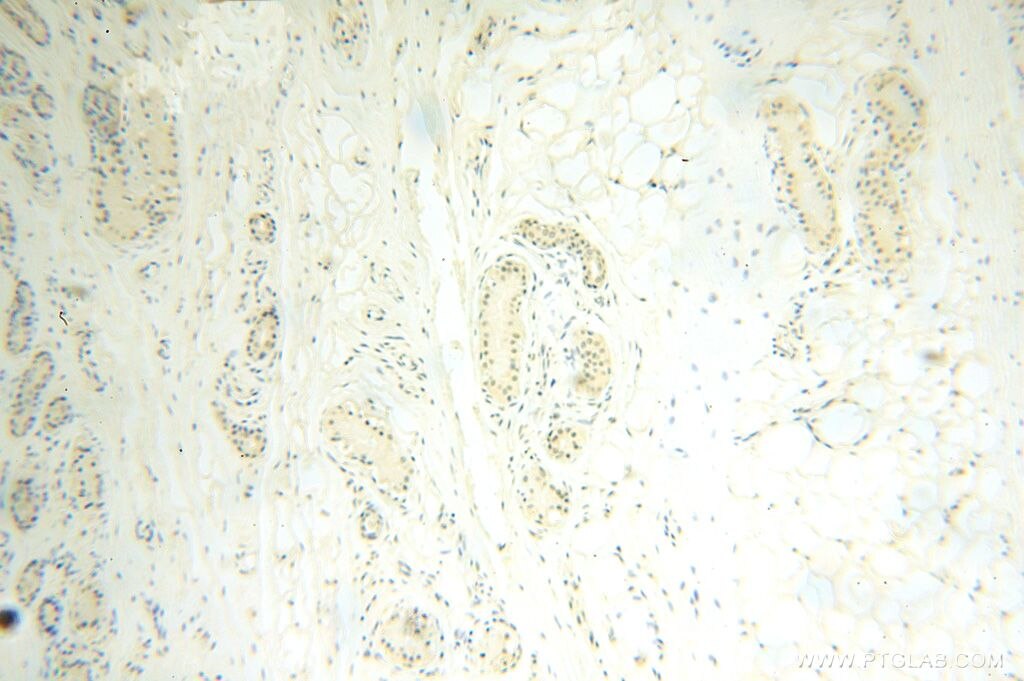 Immunohistochemistry (IHC) staining of human skin tissue using POLR1C Polyclonal antibody (15923-1-AP)