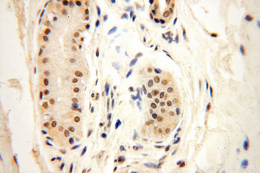 Immunohistochemistry (IHC) staining of human skin tissue using POLR1C Polyclonal antibody (15923-1-AP)