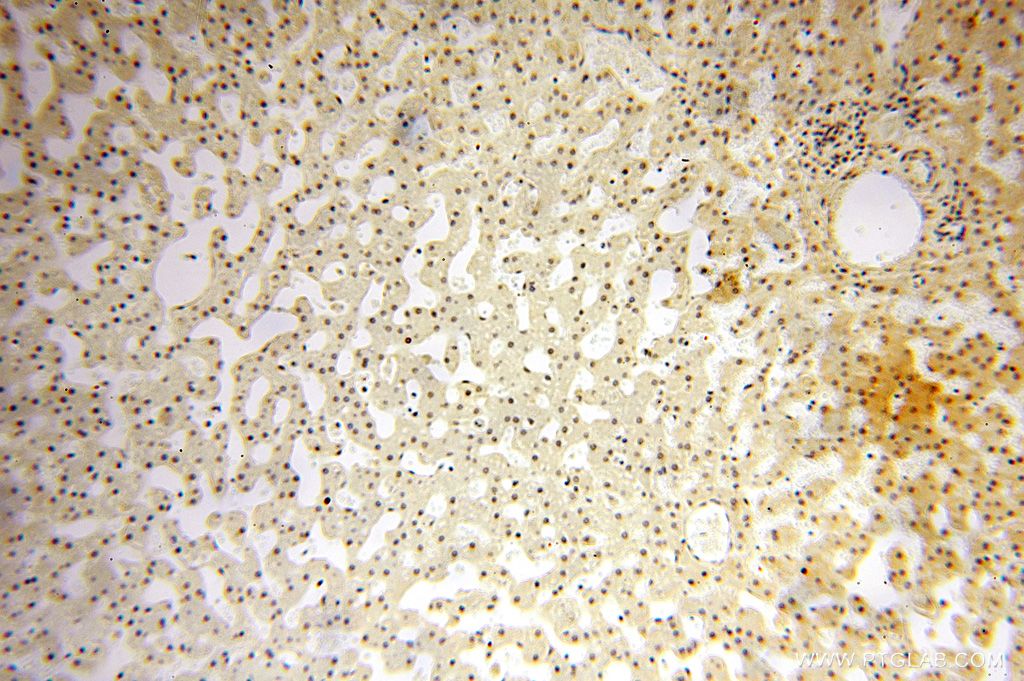 Immunohistochemistry (IHC) staining of human liver tissue using POLR1C Polyclonal antibody (15923-1-AP)