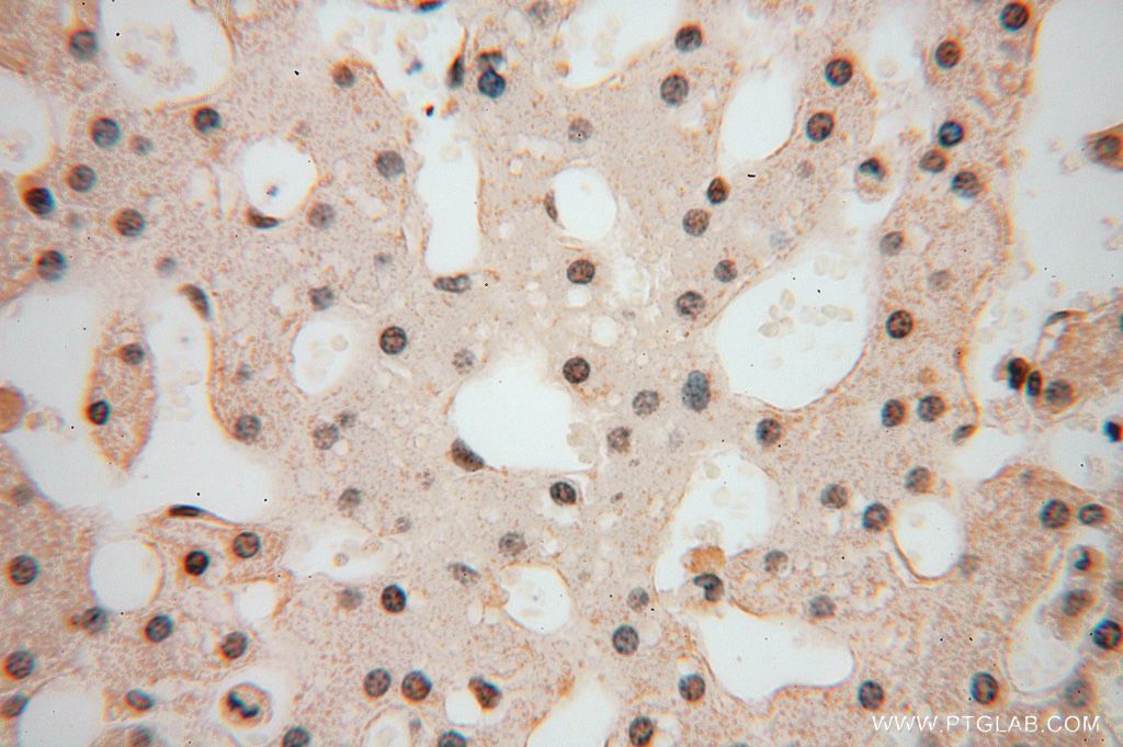 Immunohistochemistry (IHC) staining of human liver tissue using POLR1C Polyclonal antibody (15923-1-AP)