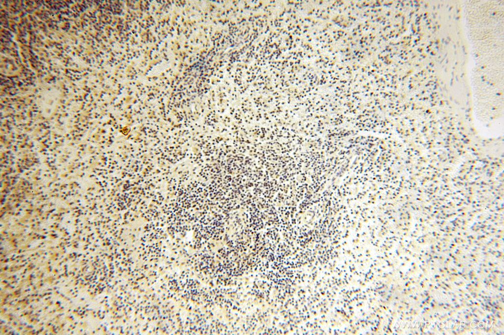 Immunohistochemistry (IHC) staining of human spleen tissue using POLR1C Polyclonal antibody (15923-1-AP)