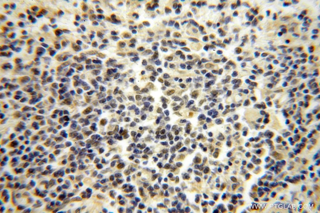 Immunohistochemistry (IHC) staining of human spleen tissue using POLR1C Polyclonal antibody (15923-1-AP)