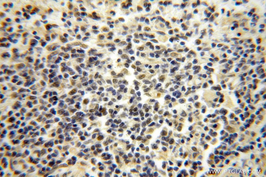 IHC staining of human spleen using 15923-1-AP