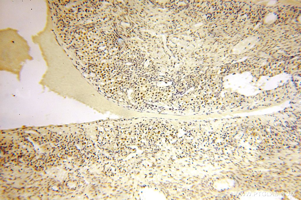 IHC staining of human ovary using 15923-1-AP
