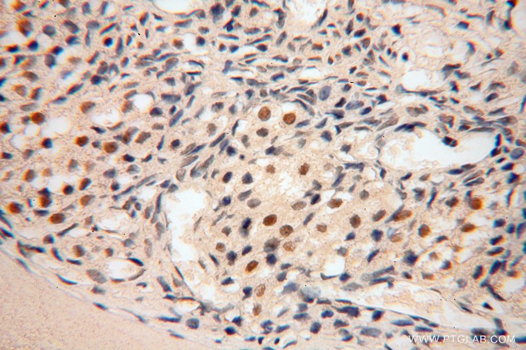 Immunohistochemistry (IHC) staining of human ovary tissue using POLR1C Polyclonal antibody (15923-1-AP)