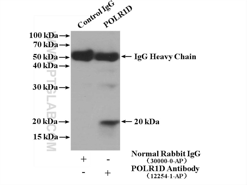 Immunoprecipitation (IP) experiment of HeLa cells using POLR1D Polyclonal antibody (12254-1-AP)