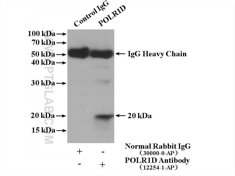 IP experiment of HeLa using 12254-1-AP